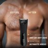 Zlade Ballistic TURBO 3.0 Full-Body Manscaping Trimmer for Men- LYF1014 - Image 2