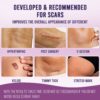 Sanfe Silicone Scar Sheet | Prevent new & treat old scars | Reduces redness, reusable | 2 sheets- SUX1007 - Image 5